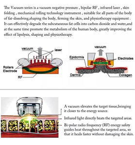 Appareil de remodelage corporel Vela, technologie révolutionnaire de massage par rouleaux sous vide, élimination de la cellulite, raffermissement de la peau, perte de poids - Product Image 5
