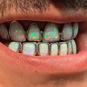 사용자 정의 오팔 보석 Grillz * 모든 치아 * 패션 인기있는 엉덩이 팝 치아 grillz 파티 춤 사진을 찍습니다