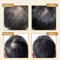 Semprotan Rambut Organik 120ml Biotin untuk Pertumbuhan Rambut, Cairan yang Diinfus dengan Bahan Herbal untuk Pertumbuhan Kembali Rambut Unisex Formula 2-in-1