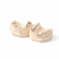 Ecolab Vitallium Cobalt Chrome Molybdenum Alloy Cast Acrylic Resin Metal RPD Framework Removable Partial Denture ISO 9001