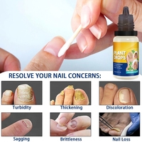 Traitement antifongique pour les ongles des orteils à base de plantes, oregano et arbre à thé, favorise la croissance des ongles, hydrate en profondeur, solution réparatrice pour les ongles, 10ml