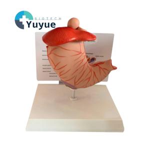 แบบจำลองการเปลี่ยนแปลงของกระเพาะอาหารในมนุษย์ สำหรับการสอนทางการแพทย์ด้านโรค<span class=keywords><strong>กระเพาะ</strong></span>อาหารและระบบทางเดินอาหาร - Product Image 1