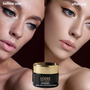 Crème éclaircissante anti-taches LOZEE, atténue le chloasma, les taches solaires, les taches de vieillesse, éclaircit le teint, hydrate, répare la peau - Product Image 3