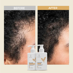 Juego de champú y acondicionador de agua de arroz Natural Qquaker, calmante, nutre el crecimiento, anticaída de cabello <span class=keywords><strong>Champu</strong></span> - Product Image 4