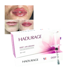 Gel d'acide hyaluronique injectable, produit de comblement dermique pour les rides du visage et le <span class=keywords><strong>volume</strong></span> des lèvres - Product Image 6