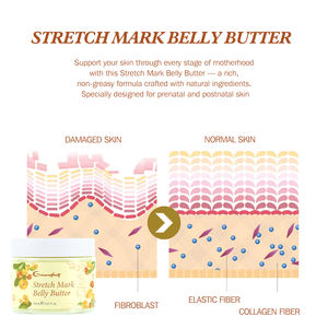 Neue Stretch Mark Bauch butter creme Shea butter Vitamin <span class=keywords><strong>E</strong></span> Kokosöl Feuchtigkeit Verbessern Sie die Haute lastizität Produkt für Dehnung streifen - Product Image 4