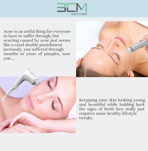 2-en-1 <span class=keywords><strong>Hydralift</strong></span> EP US/IT Plug Hydradermabrasion Nettoyage de la peau du visage Machine de beauté Appareil d'hydradermabrasion de bureau - Product Image 4