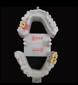 Prothèses dentaires d'<span class=keywords><strong>implant</strong></span> adaptées au système d'implantation traditionnel en <span class=keywords><strong>zircone</strong></span> ou couronne Pfm à des <span class=keywords><strong>prix</strong></span> abordables - Product Image 2