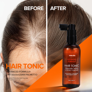 Spray OEM per la Crescita dei Capelli con Caffeina, Blocca DHT, Anti-Caduta, <span class=keywords><strong>Tonico</strong></span> Nutriente per <span class=keywords><strong>il</strong></span> Cuoio Capelluto con Estratto di Rosmarino e Saw Palmetto - Product Image 2