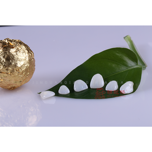 Placages dentaires Emax en céramique porcelaine <span class=keywords><strong>couronne</strong></span> et pont prothèse dentaire Pfm avec dents haute résistance - Product Image 6