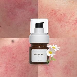 Sérum Réparateur de Barrière Cutanée OEM à la Camomille Anti-Rougeurs, Anti-Inflammatoire, Apaisant pour la Rosacée, Soulagement des Démangeaisons, Soin <span class=keywords><strong>Visage</strong></span> Peaux Sensibles - Product Image 1