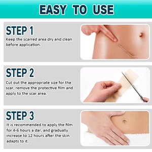 Bande adhésive cicatrisante en <span class=keywords><strong>silicone</strong></span> imperméable de 1,5 m – Produit de beauté et de soins personnels pour prévenir la prolifération des cicatrices - Product Image 3