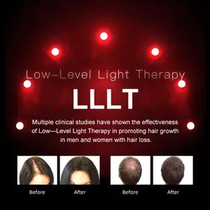 660nm saç büyümek makinesi lazer şapka Lllt Led saç büyüme Capillus lazer saç dökülmesi için 126 diyot düşük ışık lazer terapi kap Caps