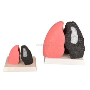 Modelo <span class=keywords><strong>de</strong></span> pulmón <span class=keywords><strong>de</strong></span> <span class=keywords><strong>fumador</strong></span> <span class=keywords><strong>de</strong></span> silicona <span class=keywords><strong>de</strong></span> tamaño pequeño para demostración <span class=keywords><strong>de</strong></span> pulmón saludable educativo - Product Image 2
