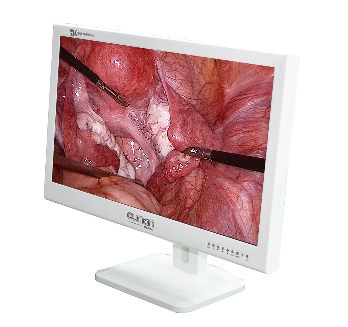 Hospital Equipment 24-Inch Endoscope Monitor LCD Medical Grade Monitor