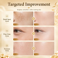 Ensemble de soins de la peau pour éclaircir, éliminer les taches de rousseur, réduire les rides, hydrater et nourrir, ensemble de soins du visage