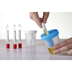 Dispositivo Desechable para el Transporte <span class=keywords><strong>de</strong></span> Muestras <span class=keywords><strong>de</strong></span> <span class=keywords><strong>Orina</strong></span> <span class=keywords><strong>de</strong></span> 100-120 ml <span class=keywords><strong>con</strong></span> <span class=keywords><strong>Tubo</strong></span> <span class=keywords><strong>de</strong></span> Recolección <span class=keywords><strong>de</strong></span> <span class=keywords><strong>Orina</strong></span> al Vacío, <span class=keywords><strong>con</strong></span> Certificación CE, ISO13485 y 510k - Product Image 6