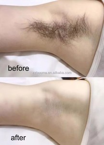 Bandes de cire dépilatoire jetables en tissu non tissé de haute qualité pour l'épilation corporelle – Vente en gros - Product Image 5