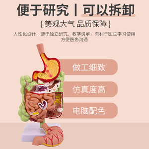 Modèle de simulation pédagogique de la pathologie du côlon humain, des maladies gastro-intestinales, des lésions du côlon, des maladies intestinales, des lésions du côlon - Product Image 5