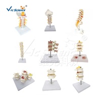 Science médicale squelette humain colonne vertébrale modèle anatomique Mini vertèbres lombaires avec sacrum et coccyx et hernie discale Mo