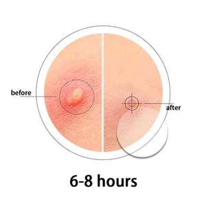 Dotdot mụn trứng cá điều trị Sticker Hydrocolloid mặc quần áo lỗ chân lông Cleaner Blemish thanh toán bù trừ mụn tùy chỉnh vá OEM nhãn hiệu riêng - Product Image 6