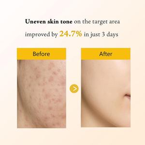 Mascarilla Facial Exfoliante de Cúrcuma y Ácido Kójico para Nutrir e Hidratar la Piel, con Logotipo Personalizado OEM - Product Image 5