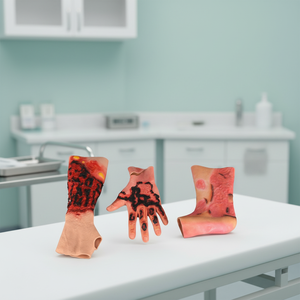 Modelo Realista de Piel con Simulación de Quemaduras <span class=keywords><strong>en</strong></span> Brazo, Mano <span class=keywords><strong>y</strong></span> Pierna para Entrenamiento de Primeros Auxilios - Product Image 5