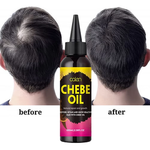 Tratamiento para la Caída del Cabello Luxfume, Aceite de Chebe 100% Natural, Promueve el Crecimiento del Cabello, Aceite Nutritivo para el Cuero Cabelludo, Alivia la <span class=keywords><strong>Caspa</strong></span> - Product Image 1