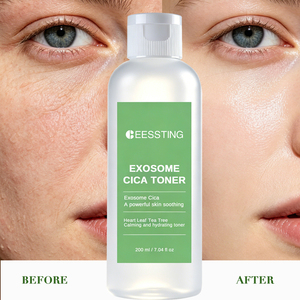 Tónico Facial CICA de Alta Calidad para el Cuidado de la Piel, Repara la Barrera Cutánea, Ilumina la Piel Opaca, Refina los Poros y da Brillo - Product Image 2