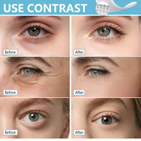Patchs micro-aiguilles OEM auto-dissolvants sous les yeux à l'acide hyaluronique et aux peptides – Masques anti-dérapants pour raffermir les rides et ridules
