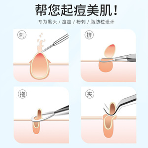 Ensemble d'aiguilles anti-acné en acier inoxydable, pointe incurvée et inclinée, pour l'élimination des points noirs du visage, outil de beauté - Product Image 5