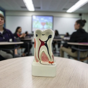 Modelo <span class=keywords><strong>de</strong></span> Patología Dental para Educación Dental y Laboratorio Dental, Modelo <span class=keywords><strong>de</strong></span> Estudio Dental - Product Image 5