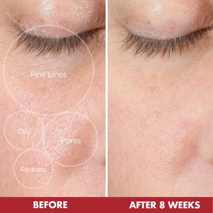 Nhãn hiệu riêng lựu tự nhiên độ ẩm chống lão hóa khuôn mặt da mặt sáng Mặt huyết thanh mặt tinh chất chăm sóc da huyết thanh - Product Image 5