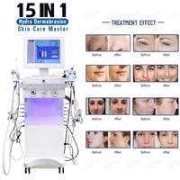 Appareil de microdermabrasion Hydra Dermabrasion avec 15 poignées en acier inoxydable pour la réduction des pores et l'anti-âge, pour usage commercial