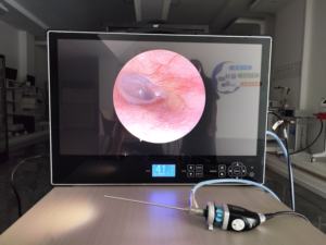 Système de caméra endoscopique portable tout-en-un, dispositifs médicaux professionnels, écran 4K avec moniteur et source lumineuse - Product Image 2