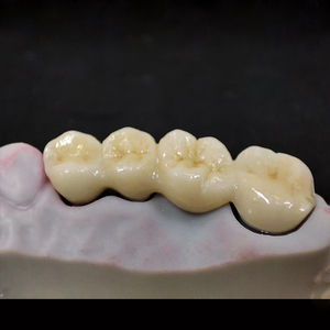 <span class=keywords><strong>Dents</strong></span> en zircone personnalisées de laboratoire dentaire numérique en Chine couronne et ponts en zircone solide - Product Image 6