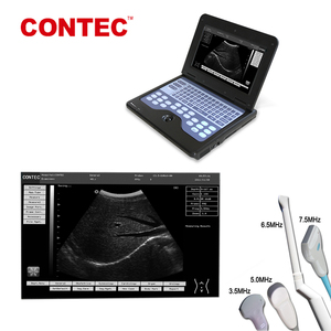 <span class=keywords><strong>Machine</strong></span> à ultrasons portable Contecmed échographie humaine vétérinaire portable - Product Image 5