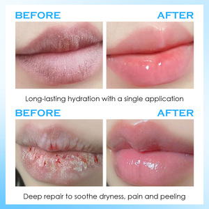 Suero Labial con Ácido Hialurónico, Hidratante, Esencia para el Cuidado de los Labios, Reduce las Líneas de los Labios, Calma los Labios Secos y Agrietados, 3 Años de Duración - Product Image 2