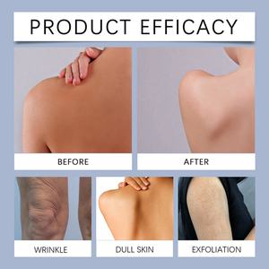 Crema Blanqueadora para el Cuidado de la Piel del Cuerpo, 30g, Hidratante, Aclara las Manchas Oscuras, Venta al Por Mayor - Product Image 6