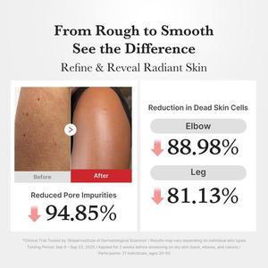 Suero de <span class=keywords><strong>Peeling</strong></span> Químico de Arroz Blanco con Ácido Hipocloroso, <span class=keywords><strong>Peeling</strong></span> <span class=keywords><strong>Facial</strong></span> con HOCl, Exfoliante Suave de Arroz, Cuidado Completo para Rostro y Cuerpo - Product Image 4