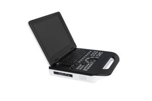 Mesin Doppler warna rumah sakit 3D, mesin <span class=keywords><strong>ultrasound</strong></span> portabel harga pabrik dengan kualitas tinggi - Product Image 3