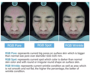Korea Professional Gesichtshaut analyze gerät Digitaler Hauts canner <span class=keywords><strong>Test</strong></span> analyze gerät Gesichtshaut analysator - Product Image 4