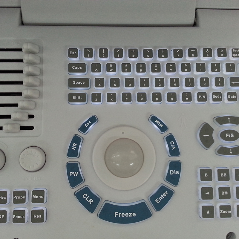 MN-S218 Clinic medical portable black and white ultrasound machine for patient diagnosis use