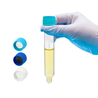 Suministros Médicos al por Mayor, Tubos de Centrífuga para Muestras de Orina de 10 ml y 12 ml, Tubos de Prueba de Sedimento de Orina con Tapa de Rosca y Función de Punción