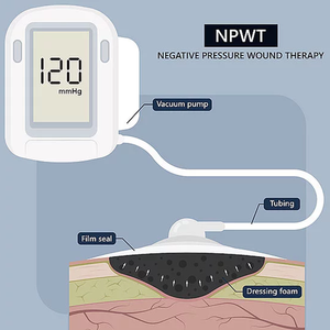 NPWTマイナス圧力創傷治療使い捨てマイナス圧力排水創傷ケアドレッシングNPWTドレッシングキット - Product Image 6
