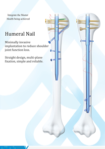 Chuyên Nghiệp Y Tế Chỉnh Hình Cấy Ghép Multiloc Humeral Lồng Vào Nhau Móng Tay 3.5 Khóa Vít - Product Image 6
