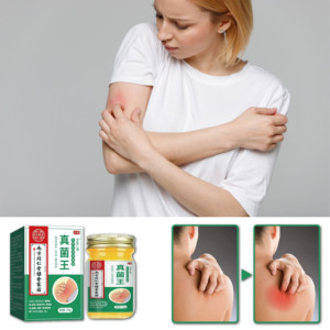Nanjing Tongrentang Fungus King's Plant Crema antipruriginosa para el cuidado del cuerpo Crema para el cuidado <span class=keywords><strong>de</strong></span> manos y pies en stock - Product Image 4