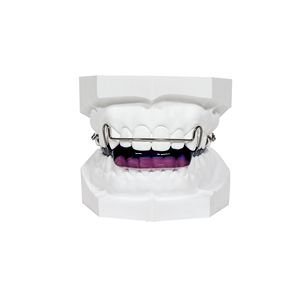 <span class=keywords><strong>Appareil</strong></span> d'expansion <span class=keywords><strong>dentaire</strong></span> amovible de classe II, plaque orthodontique en acrylique pour le redressement des dents, personnalisation - Product Image 2