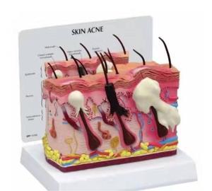 Modello anatomico della pelle umana per la biologia oggetto di metallo modello di occhio per <span class=keywords><strong>le</strong></span> scuole per gli ospedali modello di insegnamento di scienza medica Acne - Product Image 4