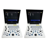 SY-AX50-1 Appareil d'échographie médicale USG le plus populaire pour la grossesse, scanner ultrasonore médical gynécologique portable